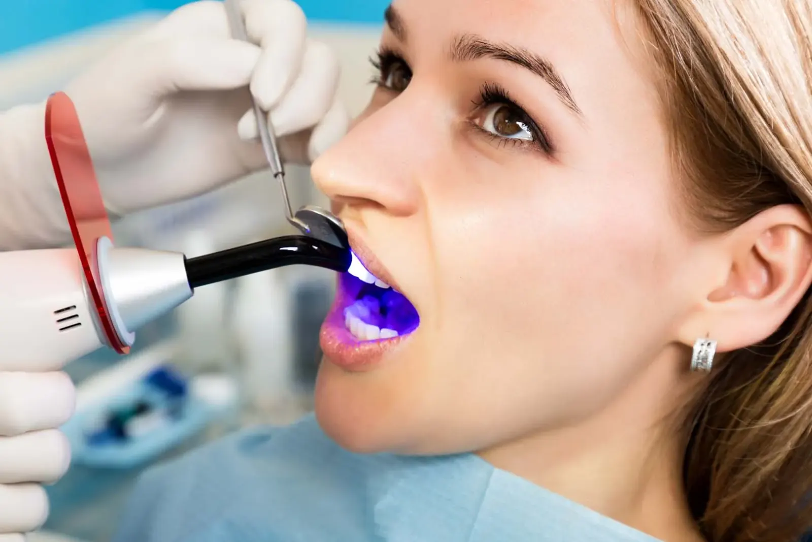 Tooth Fillings Right Here in Newkirk, OK